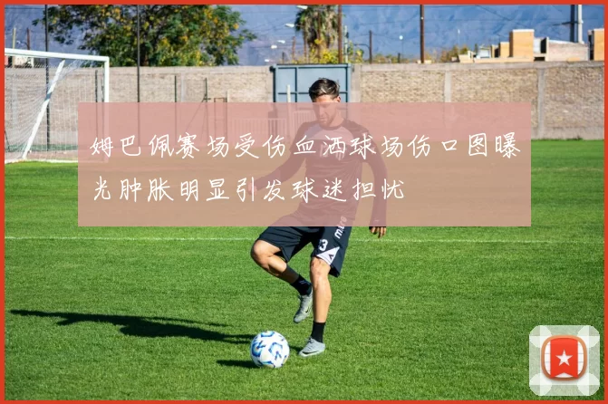 姆巴佩赛场受伤血洒球场伤口图曝光肿胀明显引发球迷担忧